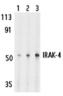 Anti Human IRAK4 (C-Terminal) Antibody gallery image 1
