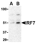 Anti Human IRF7 Antibody gallery image 1