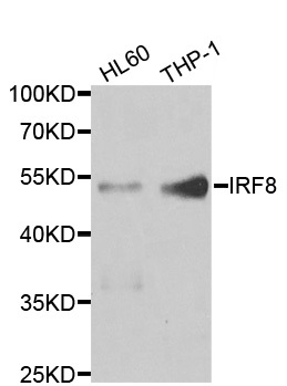 Anti IRF8 Antibody gallery image 1
