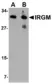 Anti IRGM (Internal Region) Antibody thumbnail image 1