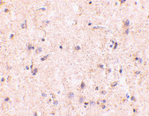 Anti IRGM (Internal Region) Antibody gallery image 2