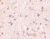 Anti IRGM (Internal Region) Antibody gallery image 2