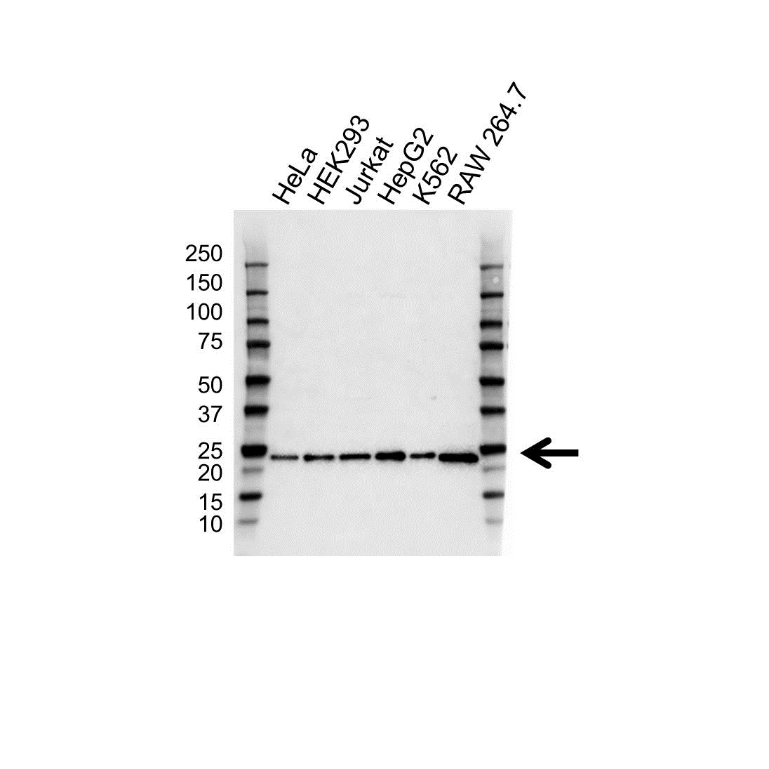 Anti Itpa Antibody (PrecisionAb Polyclonal Antibody) gallery image 1