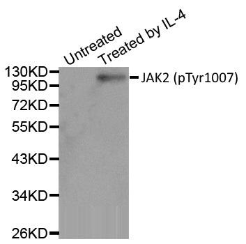 Anti JAK2 (pTyr1007) Antibody gallery image 1