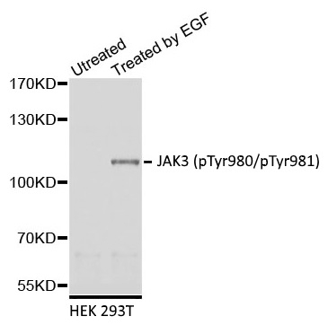 Anti JAK3 (pTyr980/pTyr981) Antibody gallery image 1