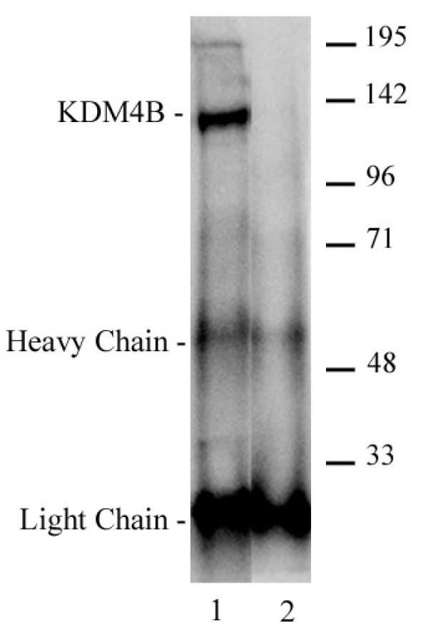 Anti Human KDM4B Antibody gallery image 1