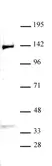 Anti Human KDM4B Antibody thumbnail image 2