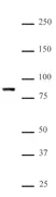Anti Human KMT2E Antibody thumbnail image 1