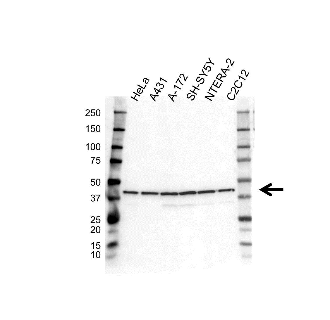 Anti LASP-1 Antibody (PrecisionAb Polyclonal Antibody) gallery image 1