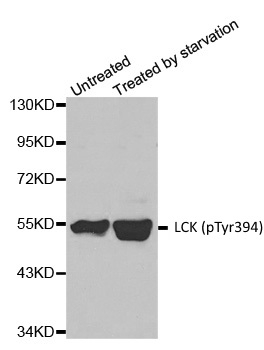 Anti Lck (pTyr394) Antibody gallery image 1