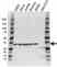 Anti LDHB Antibody (PrecisionAb Polyclonal Antibody) thumbnail image 1