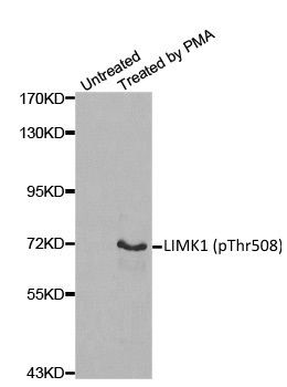 Anti LIMK1 (pThr508) Antibody gallery image 1