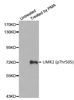 Anti LIMK2 (pThr505) Antibody gallery image 1