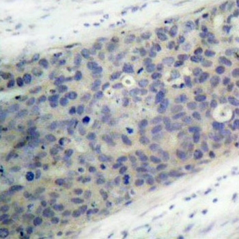 Anti LIMK2 (pThr505) Antibody gallery image 2