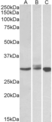 Anti Human Livin (C-Terminal) Antibody thumbnail image 1