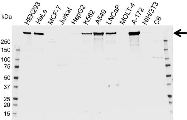 Anti LRRK2 Antibody (PrecisionAb Polyclonal Antibody) gallery image 1
