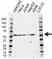 Anti LXR Beta Antibody (PrecisionAb Polyclonal Antibody) thumbnail image 1