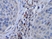 Anti Human M-CSF Antibody thumbnail image 1