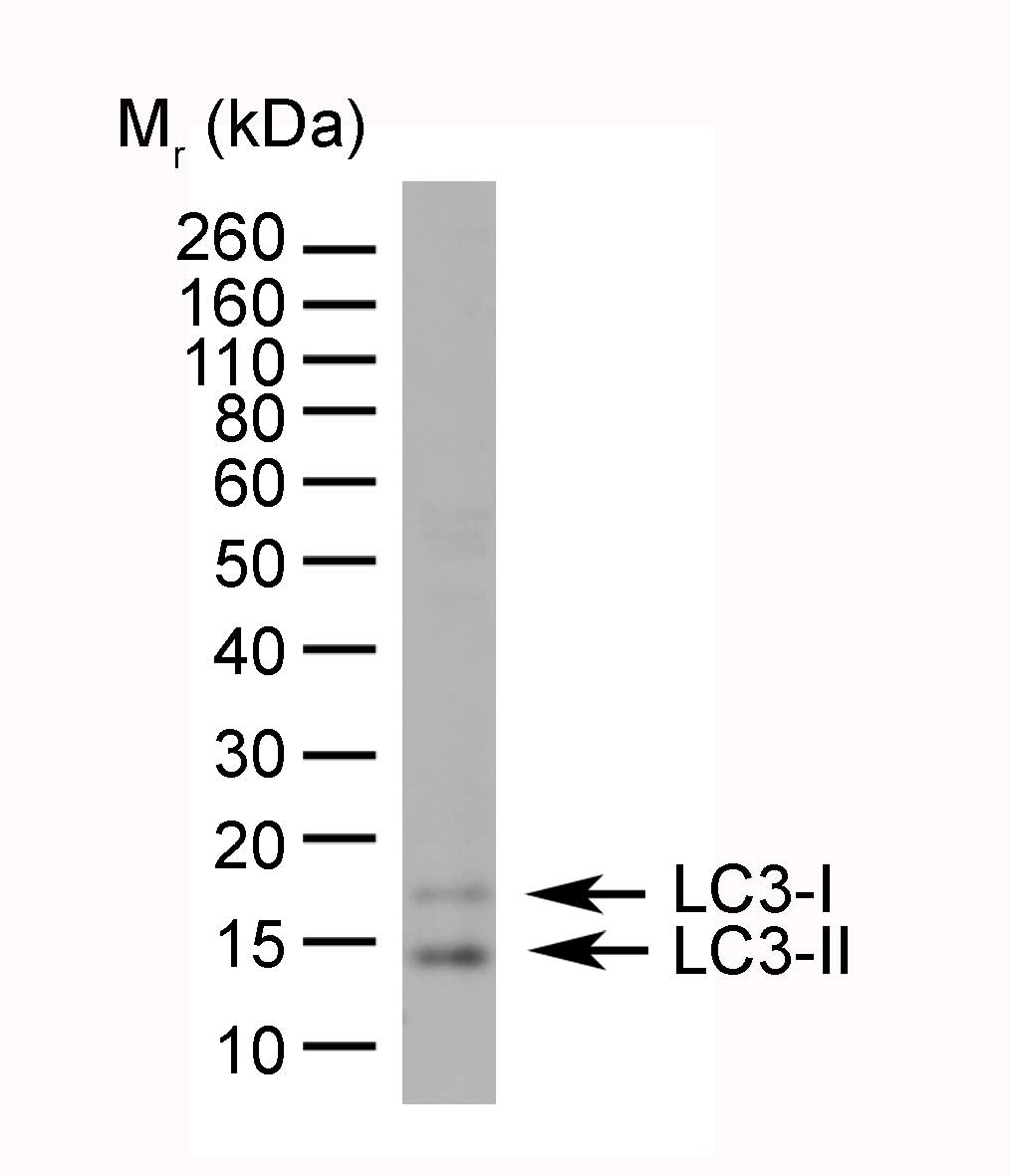 Anti Human MAP1LC3A/B (N-Terminal) Antibody gallery image 1