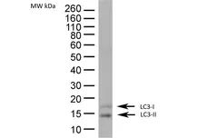 Anti Human MAP1LC3A/B (N-Terminal) Antibody gallery image 1