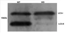 Anti Human MAP1LC3A/B (N-Terminal) Antibody gallery image 2