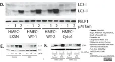 Anti Human MAP1LC3A/B (N-Terminal) Antibody gallery image 3