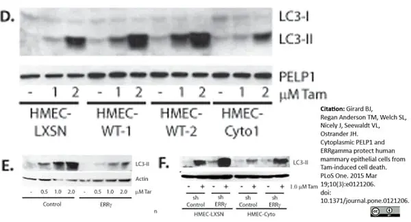 Anti Human MAP1LC3A/B (N-Terminal) Antibody gallery image 3
