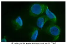 Anti Human MAP1LC3A/B (N-Terminal) Antibody gallery image 4