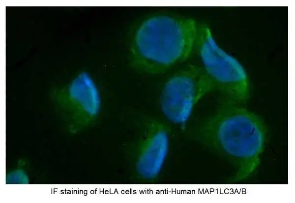 Anti Human MAP1LC3A/B (N-Terminal) Antibody gallery image 4