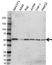 Anti MAP3K8 Antibody (PrecisionAb Polyclonal Antibody) thumbnail image 1