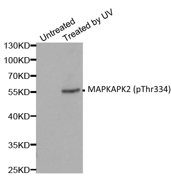 Anti MAPKAPK2 (pThr334) Antibody gallery image 1