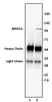 Anti Human MED15 Antibody thumbnail image 1