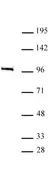 Anti Human MED15 Antibody thumbnail image 2