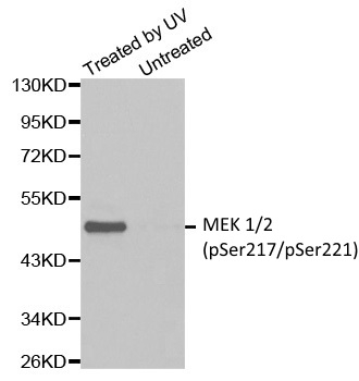 Anti MEK 1/2 (pSer217/pSer221) Antibody gallery image 1