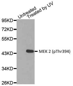Anti MEK 2 (pThr394) Antibody gallery image 1