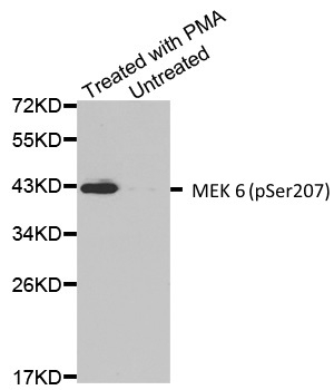 Anti MEK 6 (pSer207) Antibody gallery image 1
