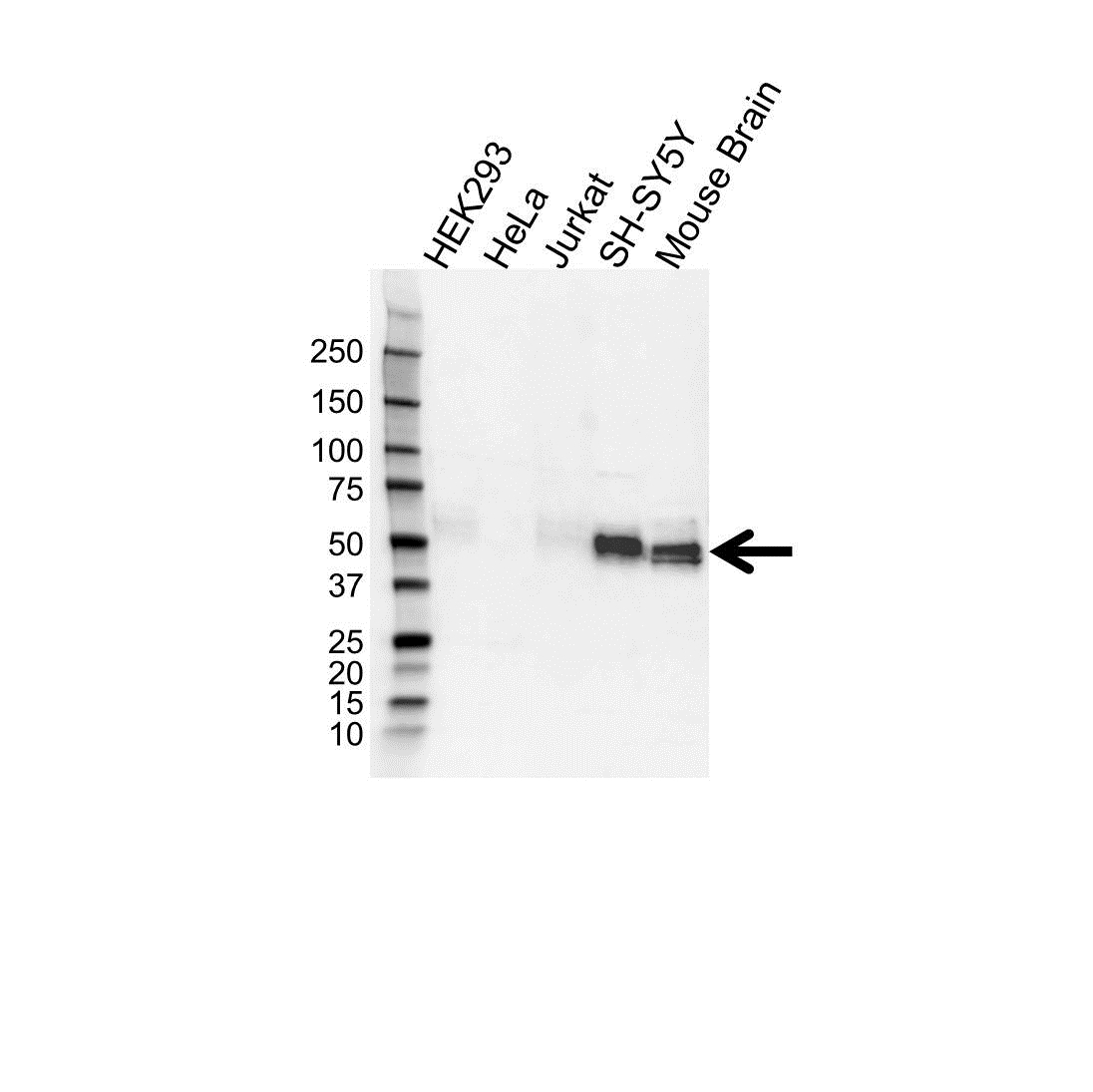 Anti Microtubule Associated Protein tau Antibody (PrecisionAb Polyclonal Antibody) gallery image 1