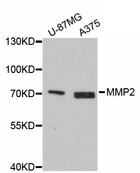 Anti MMP-2 Antibody gallery image 1