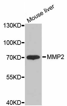 Anti MMP-2 Antibody gallery image 2