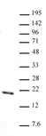 Anti Mono-Methyl-Histone H3 (Lys36) Antibody thumbnail image 1