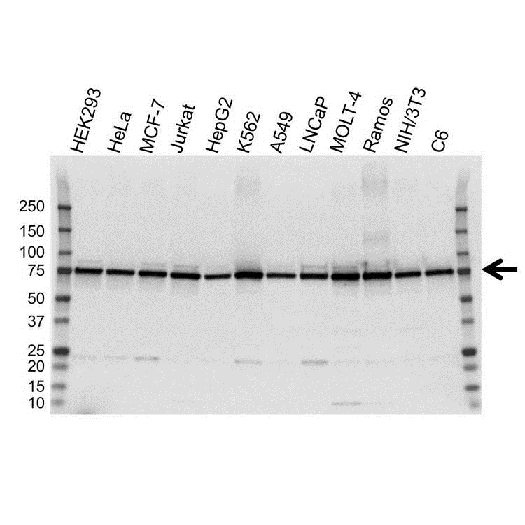MTA1L1 Antibody (PrecisionAb Antibody)|VPA00092