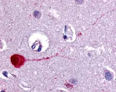 Anti Human Muscarinic Receptor M3 Antibody gallery image 1