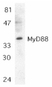 Anti MyD88 (C-Terminal) Antibody thumbnail image 1