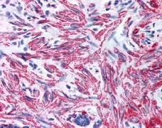 Anti Human Myosin Regulatory Light Chain Antibody gallery image 1