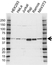 Anti NCF1 Antibody (PrecisionAb Polyclonal Antibody) thumbnail image 1