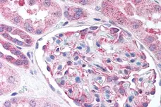 Anti Human Nestin Antibody gallery image 2