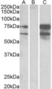 Anti Human Neurexin 1 (C-Terminal) Antibody thumbnail image 1