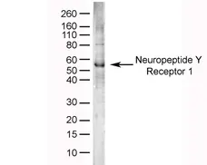Anti Human Neuropeptide Y Receptor 1 Antibody gallery image 1