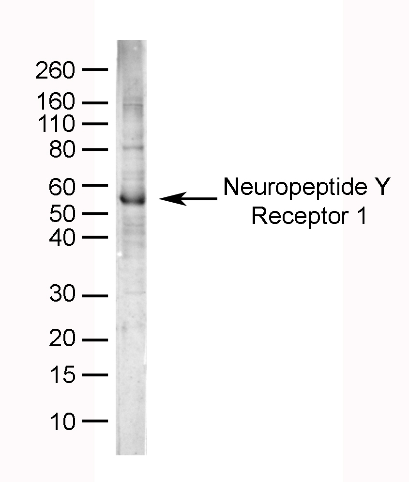 Anti Human Neuropeptide Y Receptor 1 Antibody gallery image 1