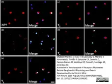 Anti Human Neuropeptide Y Receptor 1 Antibody gallery image 2